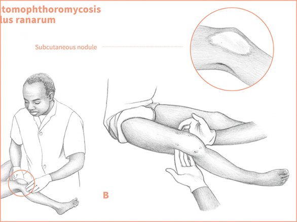 Mimicry of Entomophthoromycoses